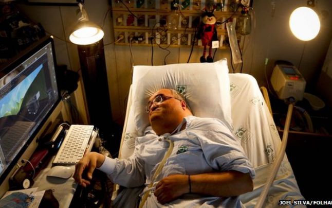 Heartwarming Story of a Man Living Nearly 45 Years in a Hospital Bed